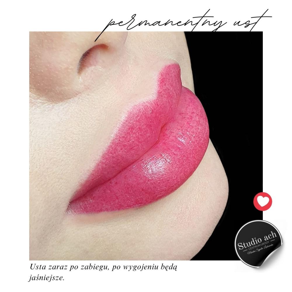 permanentny-ust-4