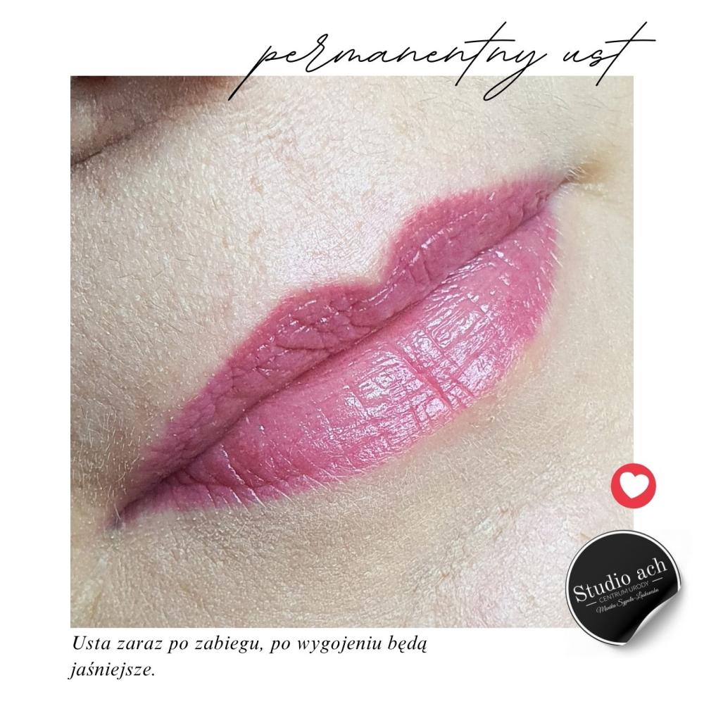 permanentny-ust-5